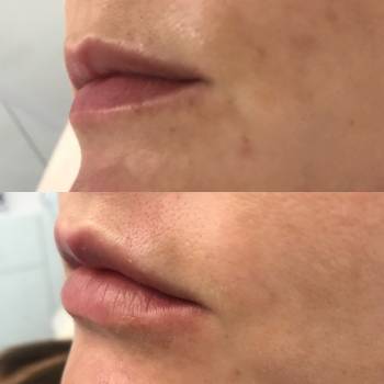 Ирина Христина , Киев Фото - 17