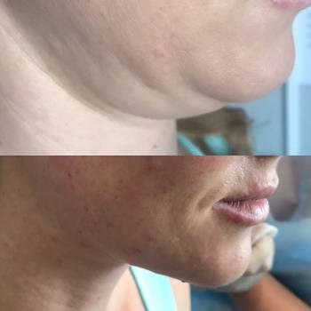 Ирина Христина , Киев Фото - 19