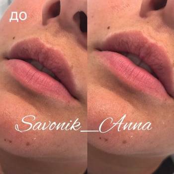 Савоник Анна , Київ Фото - 5