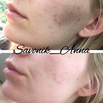 Савоник Анна , Київ Фото - 9