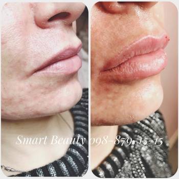 Фото с портфолио Smart Beauty