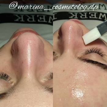 Фото с портфолио Марина 