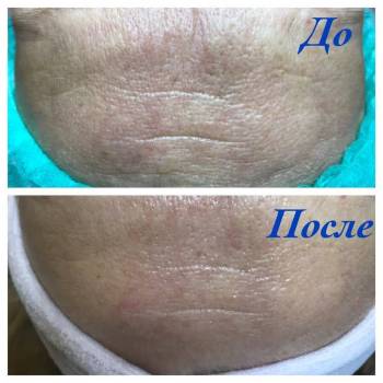 Анна Червина , Дніпро Фото - 8