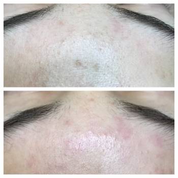 Анна Червина , Дніпро Фото - 1