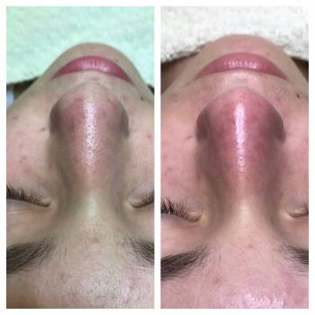 Анна Червина , Дніпро Фото - 11