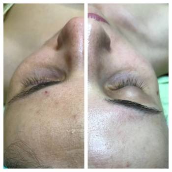 Анна Червина , Дніпро Фото - 12