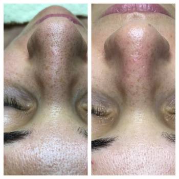 Анна Червина , Дніпро Фото - 13