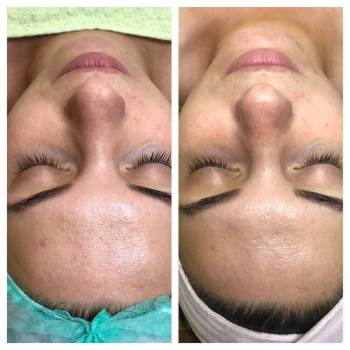 Анна Червина , Дніпро Фото - 14