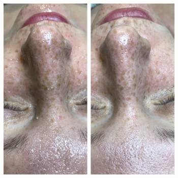 Анна Червина , Дніпро Фото - 15