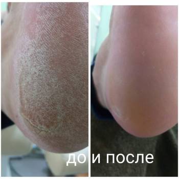 Фото с портфолио Фрейя