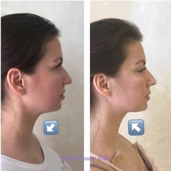 Chika Beauty, Київ Фото - 5