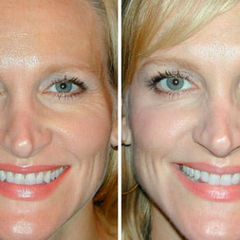 Фото с портфолио Татьяна Аскерова 