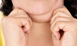 Мезотерапия от "второго подбородка" у мужчин Косметолог-инъекционист Елена Харьков