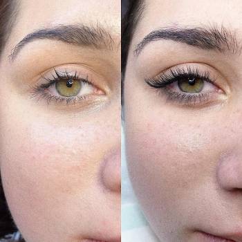 Фото с портфолио Lashes Hub