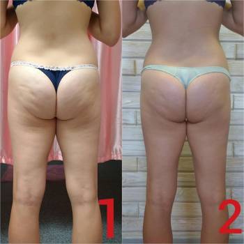 Фото с портфолио Юлия Москаленко 