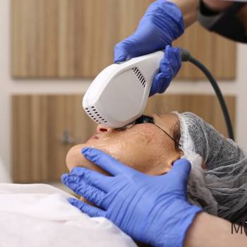 My Skin, Винница Фото - 6