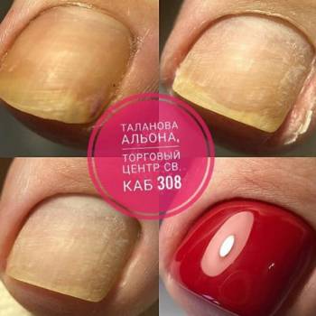 Фото с портфолио Альона Таланова 