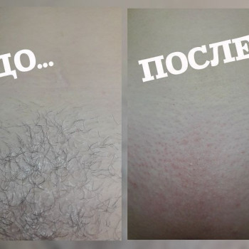 Глубокое бикини