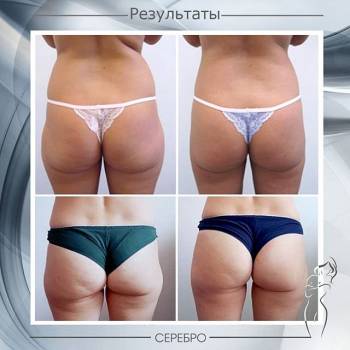 Серебро, Одесса Фото - 53