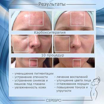 Серебро, Одесса Фото - 54