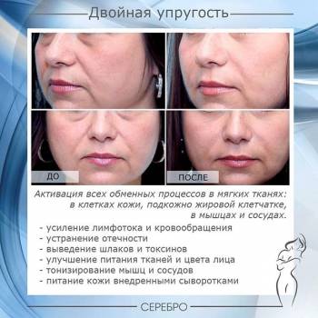 уколи ботокса для обличчя, масаж обличчя, корекціяз моршок
