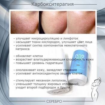 Серебро, Одесса Фото - 59