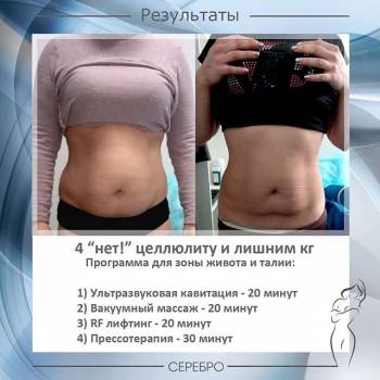 Серебро, Одесса Фото - 67