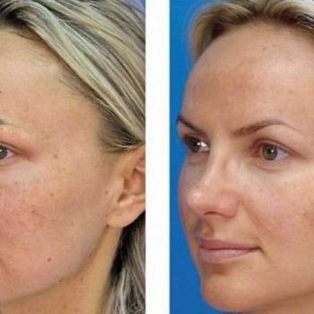 Фото с портфолио Роман Навроцкий 