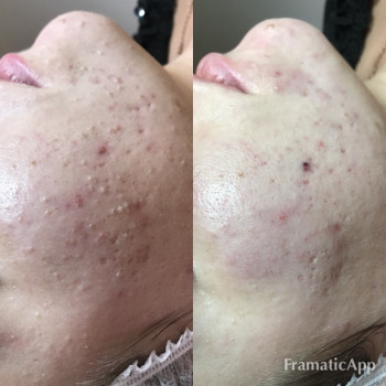 Фото с портфолио Яна Ончєва