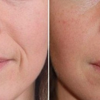 Фото с портфолио Виктория Барановская 