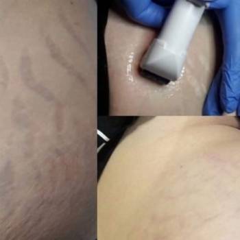 Фото с портфолио Коренькова Екатерина 