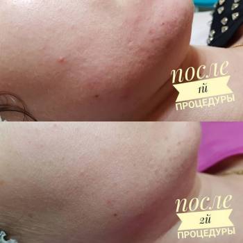 Фото с портфолио Коренькова Екатерина 