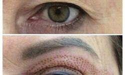 Удаление надвисшего века Мастер перманентного макияжа Маша Есипова Харьков