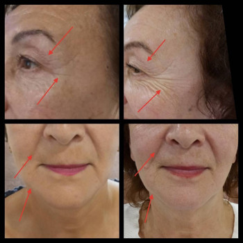 Изменение цвета лица, уменьшение морщин, повышение эластично, фото - преподаватель курсов красоты Светлана Стадницкая