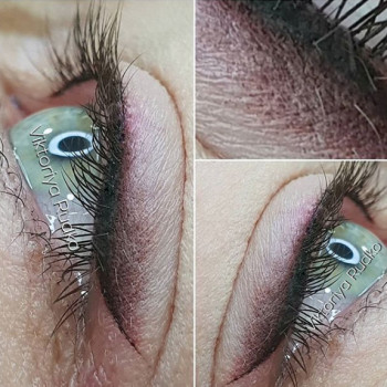 Сразу после процедуры
