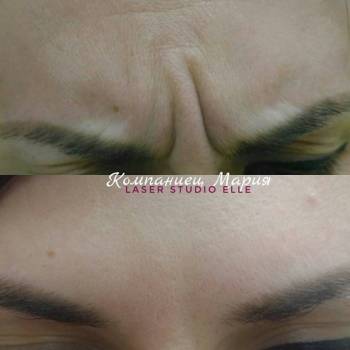 Elle, Полтава Фото - 7