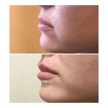 Elle, Полтава Фото - 8