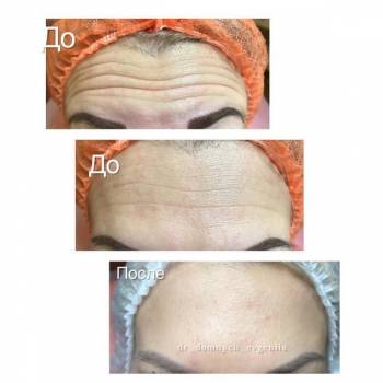 Elle, Полтава Фото - 12