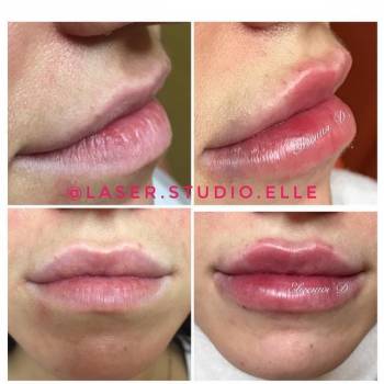 Elle, Полтава Фото - 14