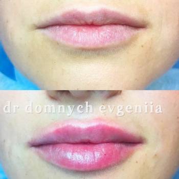 Elle, Полтава Фото - 29