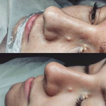 Дарья Суслова , Полтава Фото - 17