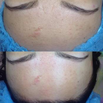 Татьяна Круговая , Полтава Фото - 7