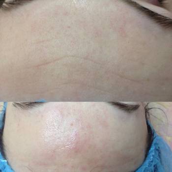 Татьяна Круговая , Полтава Фото - 10