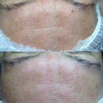 Татьяна Круговая , Полтава Фото - 11