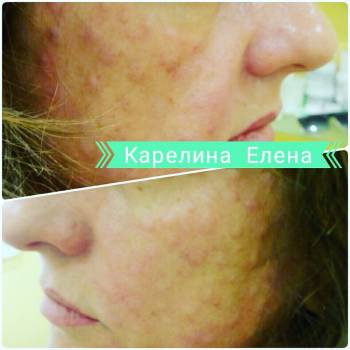 Елена Карелина, Кривой Рог Фото - 10