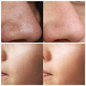 Фото с портфолио Юлия Евдошенко 