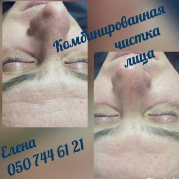 Елена Плакса , Полтава Фото - 8