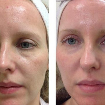 Фото с портфолио Оля 