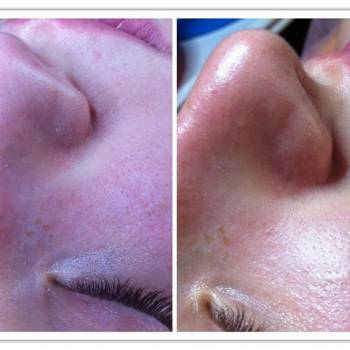 Фото с портфолио Марина 