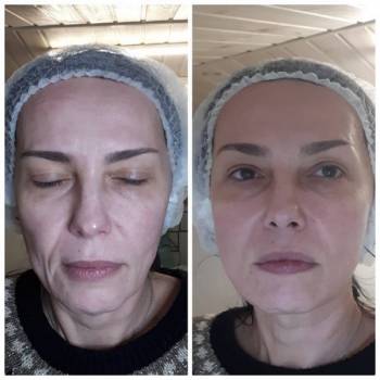 Фото с портфолио Марина 